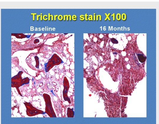 Before After Trichrome Stain